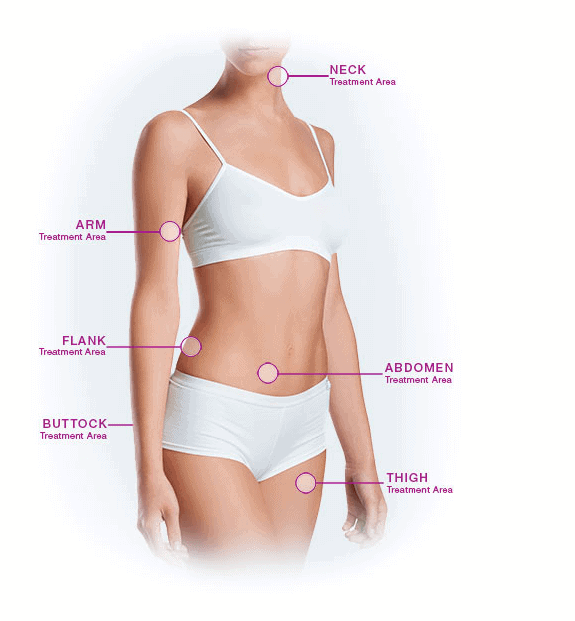 VelaShape review body contouring device