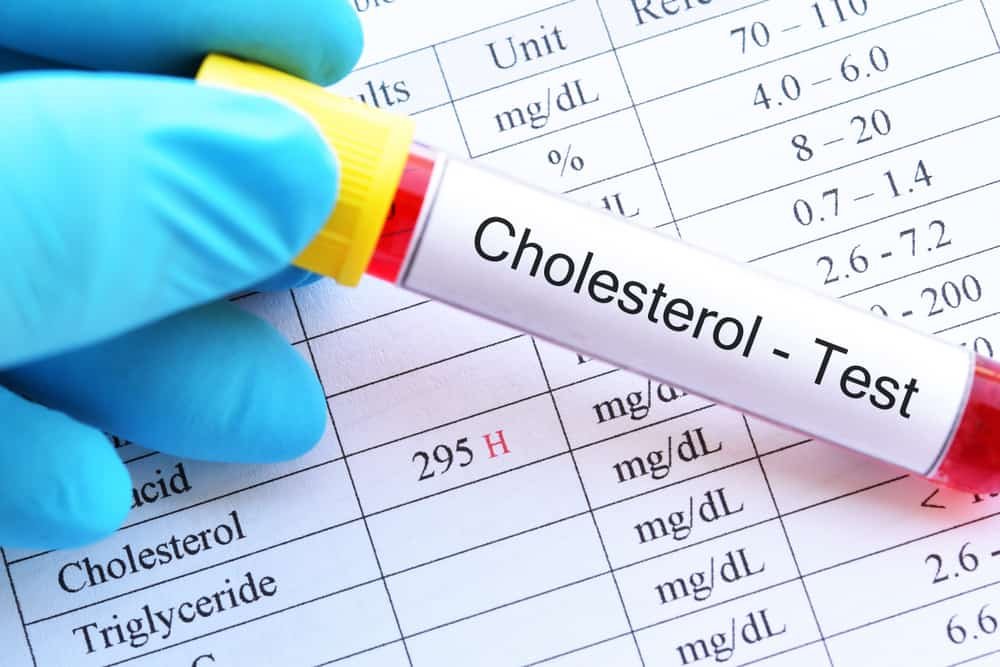 Cholesterol test
