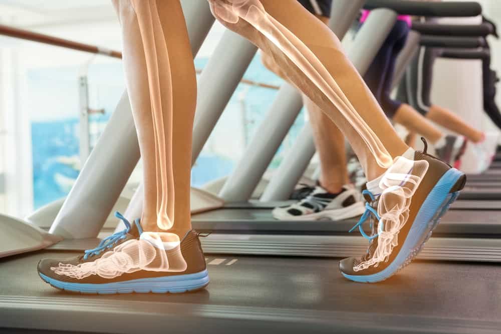 Dieting and bone health
