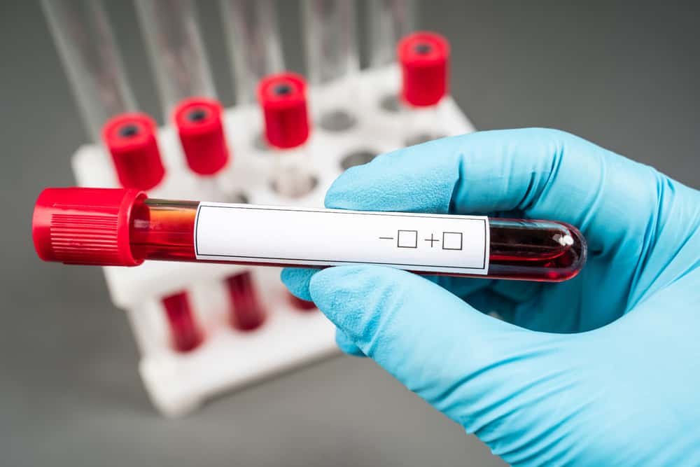 Cholesterol screening